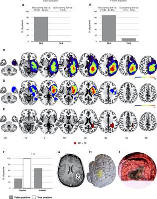 Transcranial versus direct electrical stimulation for intraoperative motor-evoked potential monitoring: Prognostic value comparison in asleep brain tumor surgery